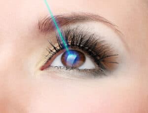 Photorefractive Keratectomy in Beverly Hills
